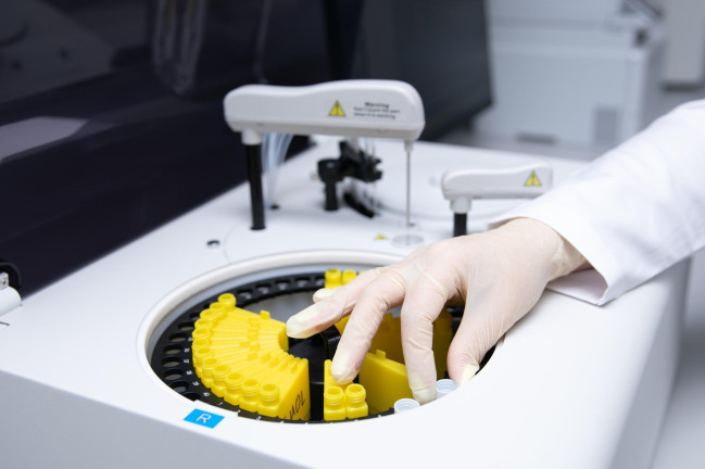 Mərkəzi Baytarlıq Laboratoriyasında biokimyəvi və hematoloji analizlər yüksək dəqiqliklə aparılır